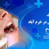 دندان ولایت