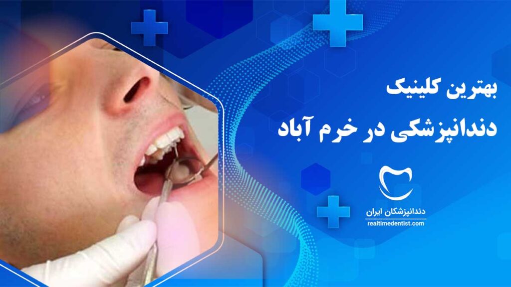دندان ولایت