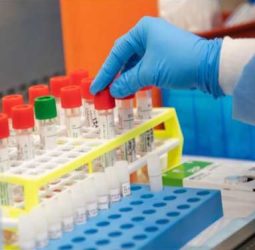 آزمایشگاه یعقوب شیرخانی