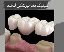 دندانپزشکی لبخند